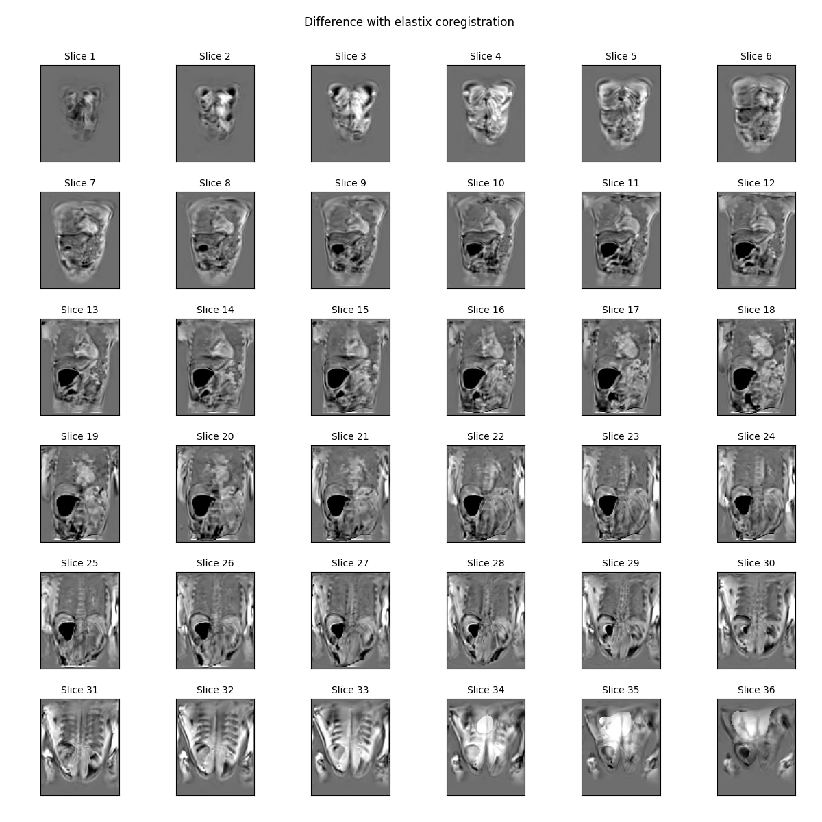Difference with elastix coregistration    , Slice 1, Slice 2, Slice 3, Slice 4, Slice 5, Slice 6, Slice 7, Slice 8, Slice 9, Slice 10, Slice 11, Slice 12, Slice 13, Slice 14, Slice 15, Slice 16, Slice 17, Slice 18, Slice 19, Slice 20, Slice 21, Slice 22, Slice 23, Slice 24, Slice 25, Slice 26, Slice 27, Slice 28, Slice 29, Slice 30, Slice 31, Slice 32, Slice 33, Slice 34, Slice 35, Slice 36