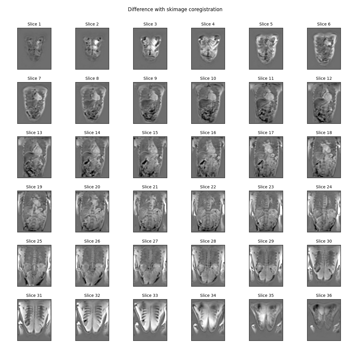 Difference with skimage coregistration    , Slice 1, Slice 2, Slice 3, Slice 4, Slice 5, Slice 6, Slice 7, Slice 8, Slice 9, Slice 10, Slice 11, Slice 12, Slice 13, Slice 14, Slice 15, Slice 16, Slice 17, Slice 18, Slice 19, Slice 20, Slice 21, Slice 22, Slice 23, Slice 24, Slice 25, Slice 26, Slice 27, Slice 28, Slice 29, Slice 30, Slice 31, Slice 32, Slice 33, Slice 34, Slice 35, Slice 36
