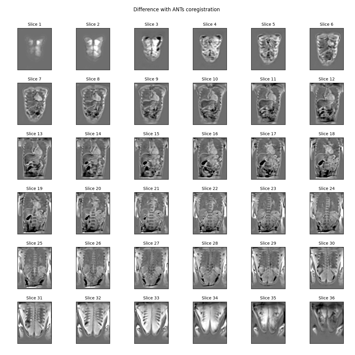 Difference with ANTs coregistration    , Slice 1, Slice 2, Slice 3, Slice 4, Slice 5, Slice 6, Slice 7, Slice 8, Slice 9, Slice 10, Slice 11, Slice 12, Slice 13, Slice 14, Slice 15, Slice 16, Slice 17, Slice 18, Slice 19, Slice 20, Slice 21, Slice 22, Slice 23, Slice 24, Slice 25, Slice 26, Slice 27, Slice 28, Slice 29, Slice 30, Slice 31, Slice 32, Slice 33, Slice 34, Slice 35, Slice 36