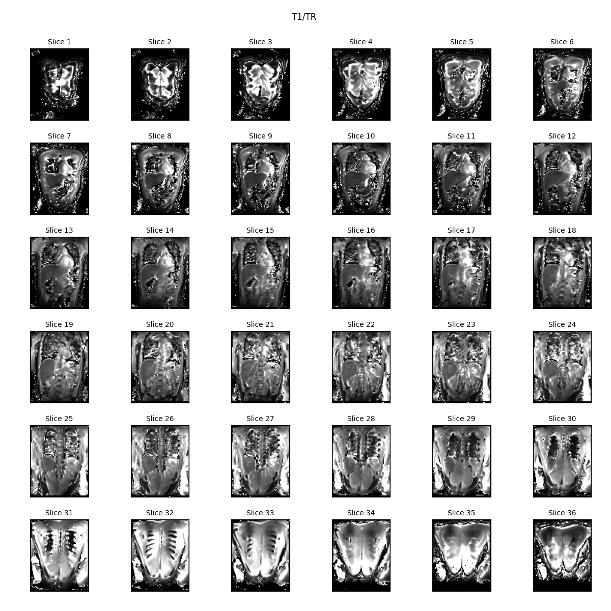 T1/TR    , Slice 1, Slice 2, Slice 3, Slice 4, Slice 5, Slice 6, Slice 7, Slice 8, Slice 9, Slice 10, Slice 11, Slice 12, Slice 13, Slice 14, Slice 15, Slice 16, Slice 17, Slice 18, Slice 19, Slice 20, Slice 21, Slice 22, Slice 23, Slice 24, Slice 25, Slice 26, Slice 27, Slice 28, Slice 29, Slice 30, Slice 31, Slice 32, Slice 33, Slice 34, Slice 35, Slice 36