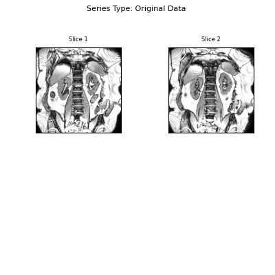 Series Type: Original Data    , Slice 1, Slice 2