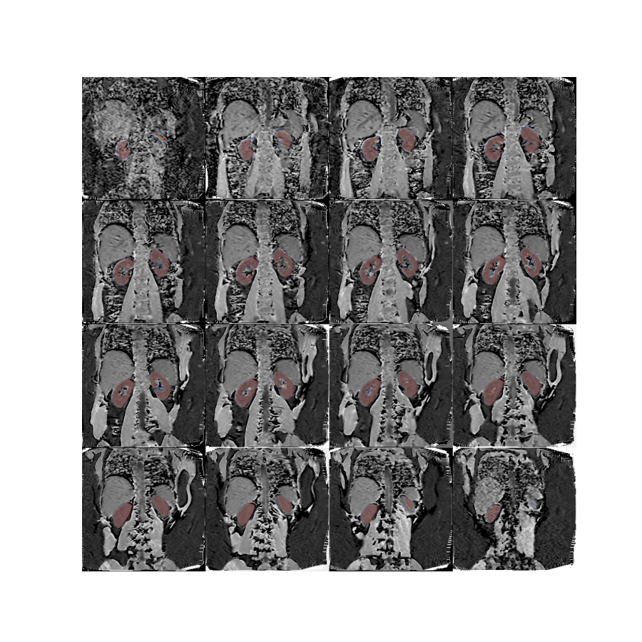 plot 3d mask translation