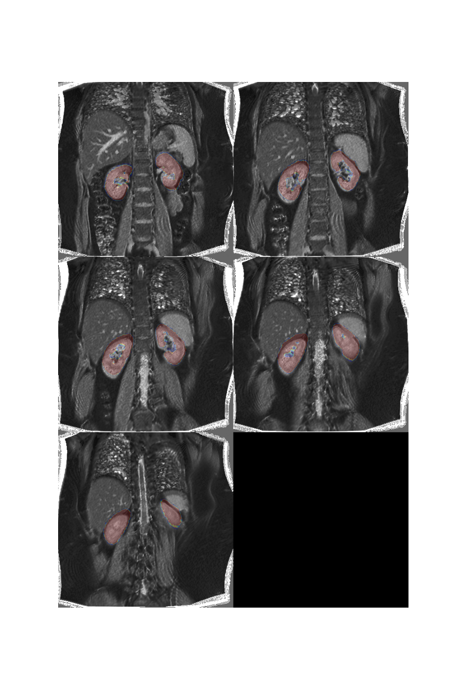 plot 3d multislice translation t1