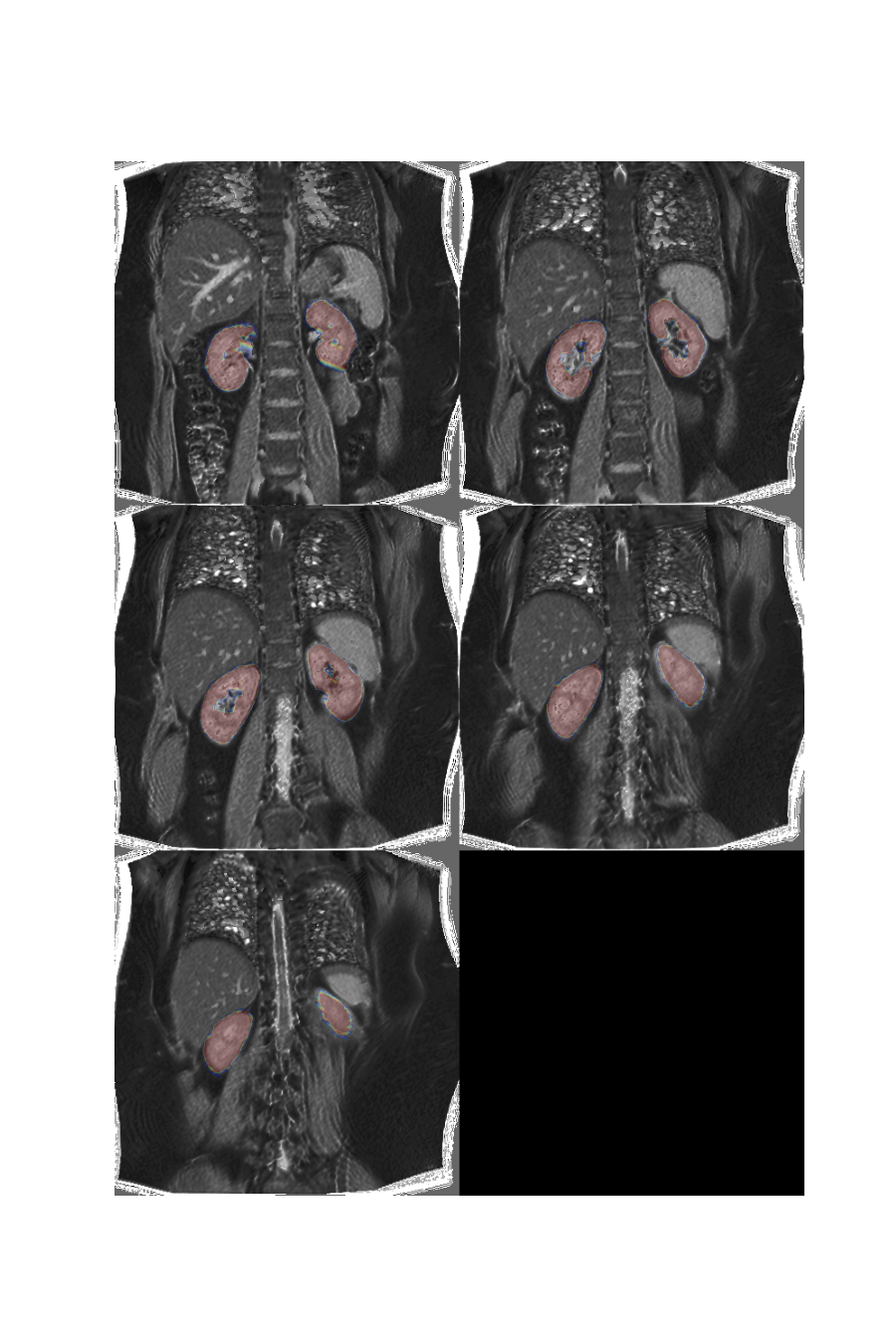 plot 3d multislice translation t1