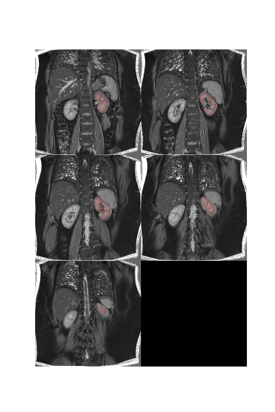 plot 3d multislice translation t1