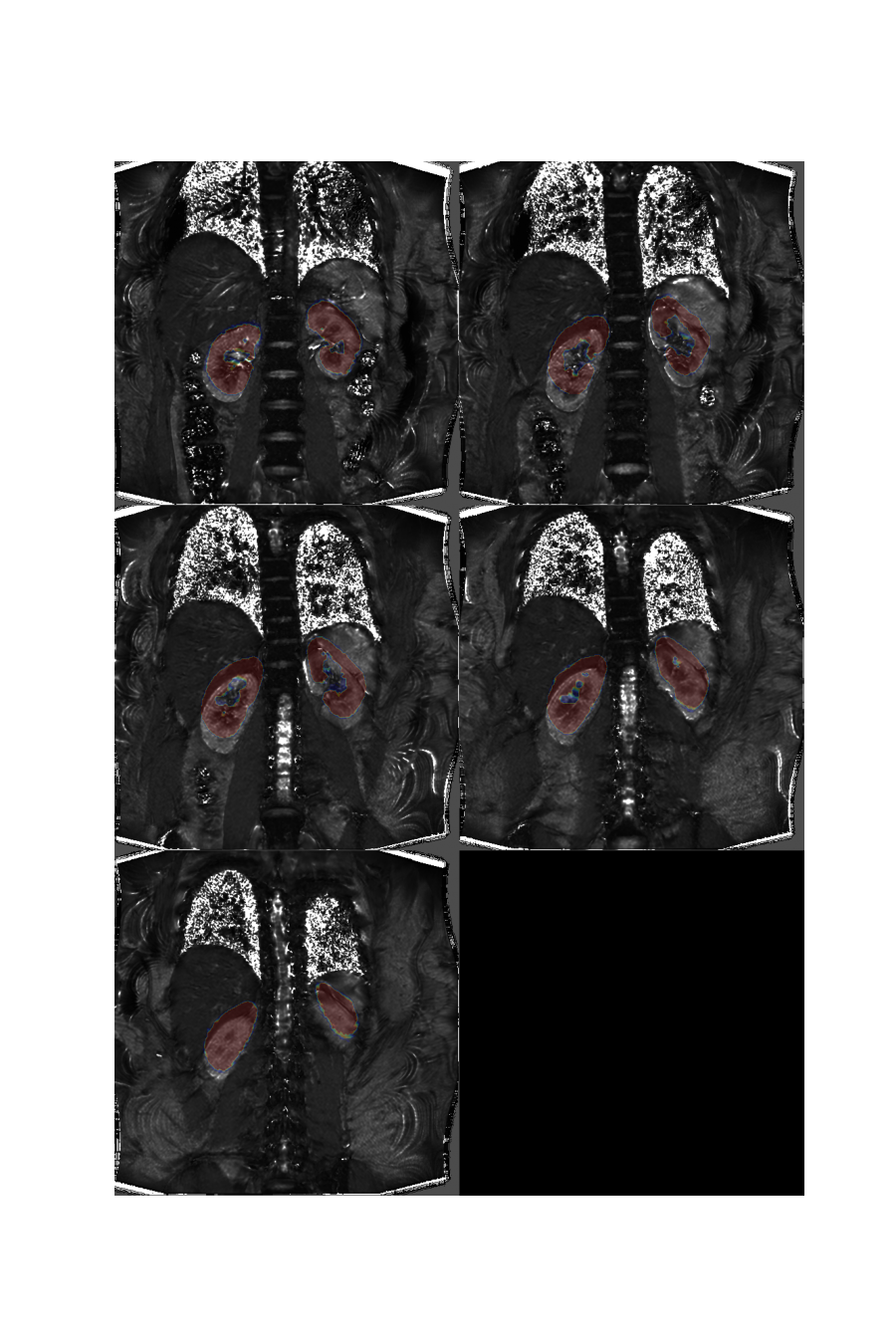 plot 3d multislice translation t2