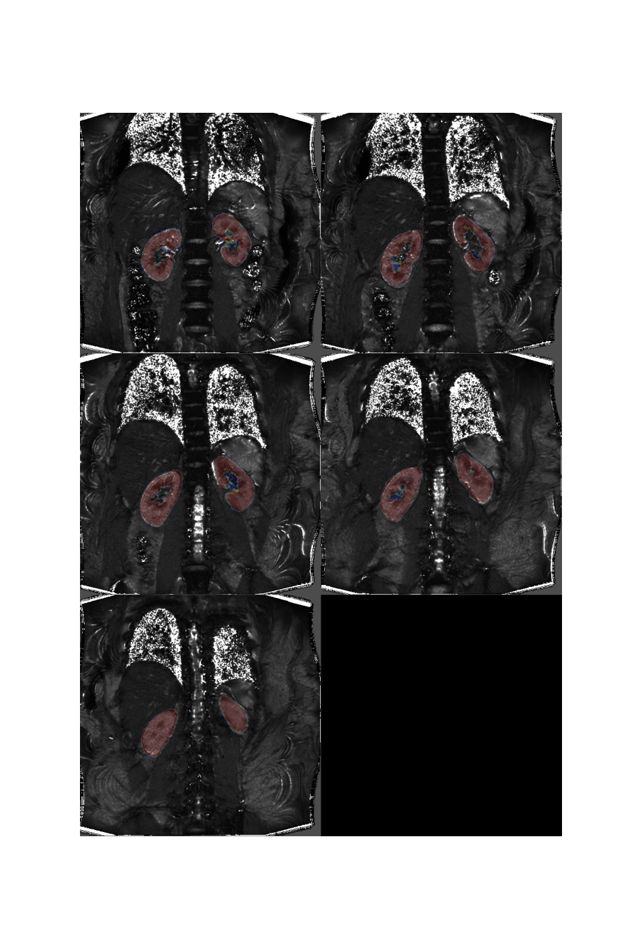plot 3d multislice translation t2