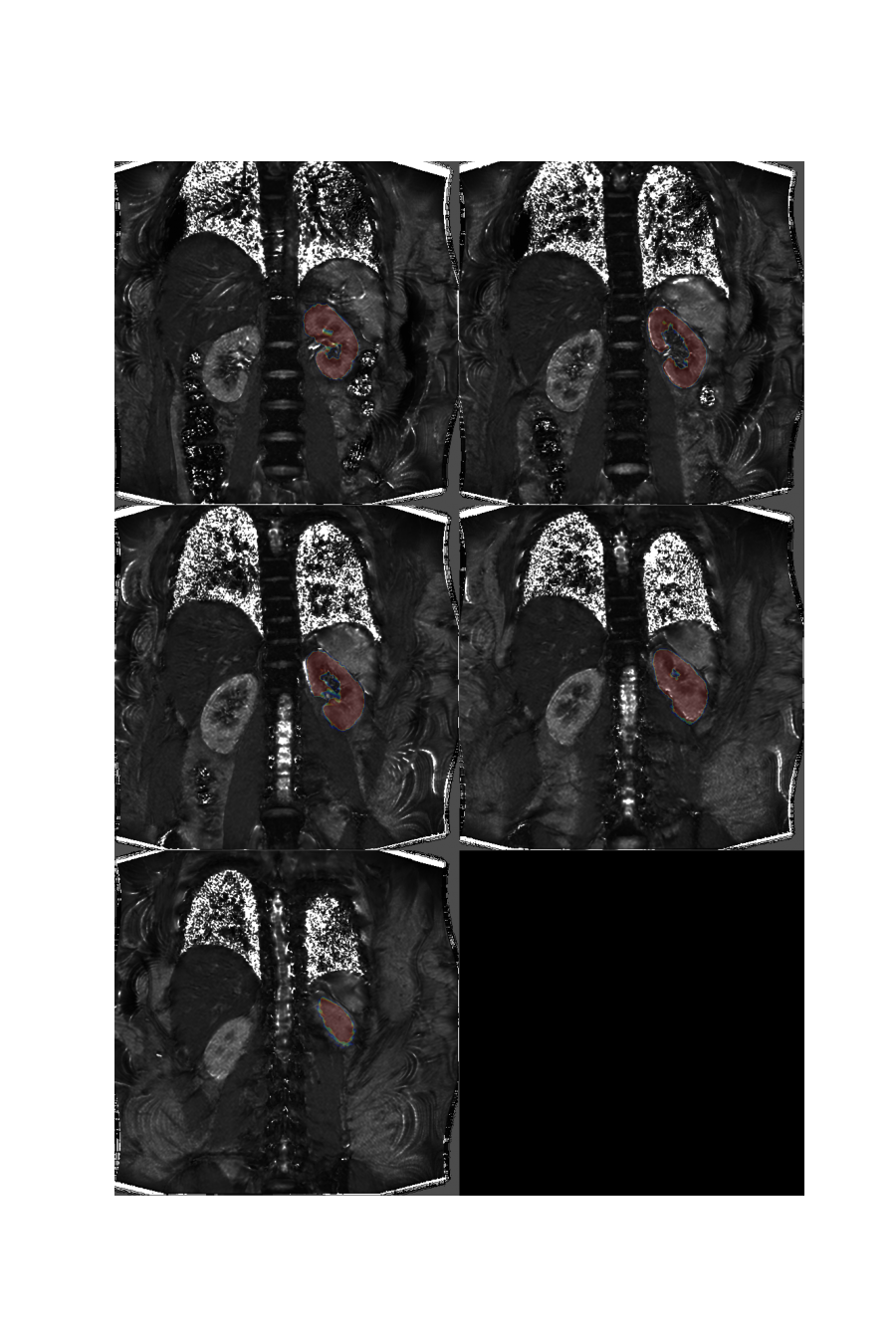 plot 3d multislice translation t2