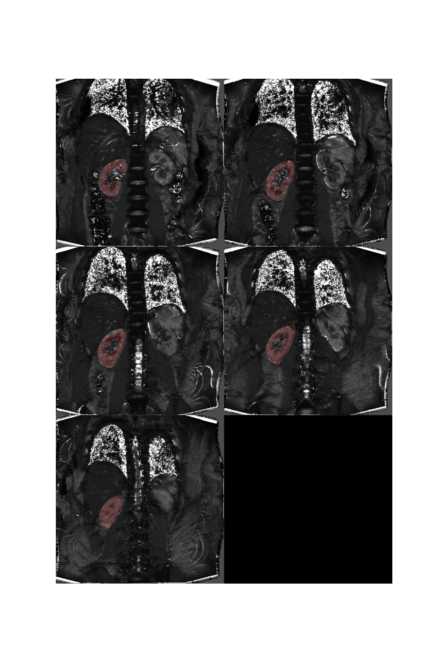 plot 3d multislice translation t2