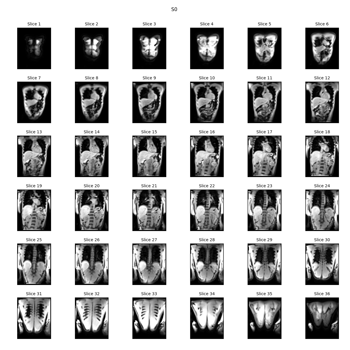 S0 , Slice 1, Slice 2, Slice 3, Slice 4, Slice 5, Slice 6, Slice 7, Slice 8, Slice 9, Slice 10, Slice 11, Slice 12, Slice 13, Slice 14, Slice 15, Slice 16, Slice 17, Slice 18, Slice 19, Slice 20, Slice 21, Slice 22, Slice 23, Slice 24, Slice 25, Slice 26, Slice 27, Slice 28, Slice 29, Slice 30, Slice 31, Slice 32, Slice 33, Slice 34, Slice 35, Slice 36